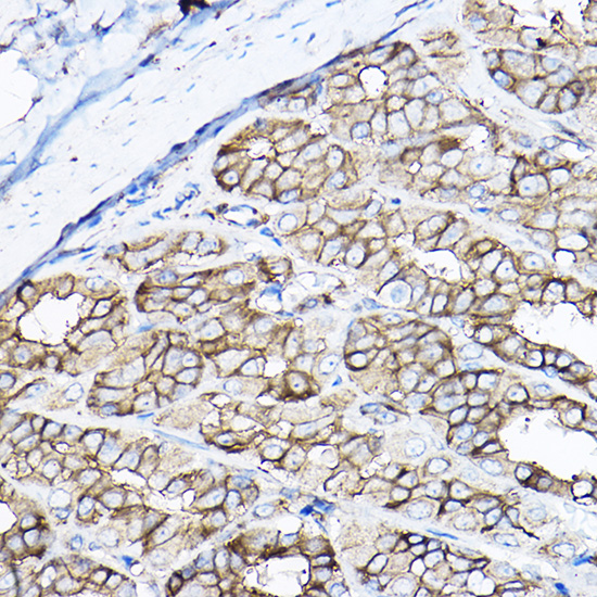 Rabbit anti-GNB2 Polyclonal Antibody