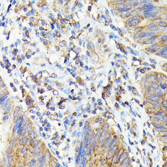 Rabbit anti-TAP2 Polyclonal Antibody