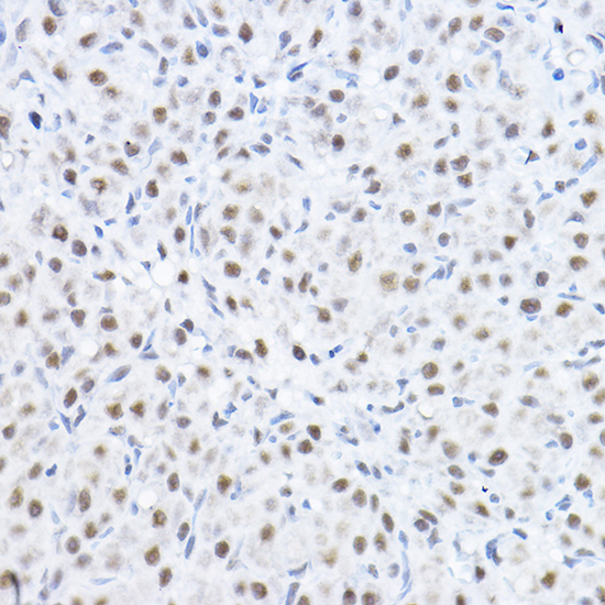 Rabbit anti-SMEK1 Polyclonal Antibody
