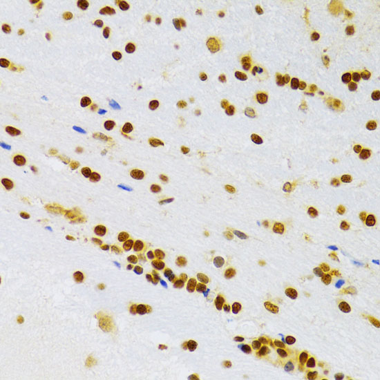 Rabbit anti-HMGB1 Polyclonal Antibody