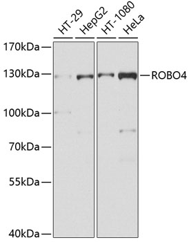 Rabbit anti-ROBO4 Polyclonal Antibody