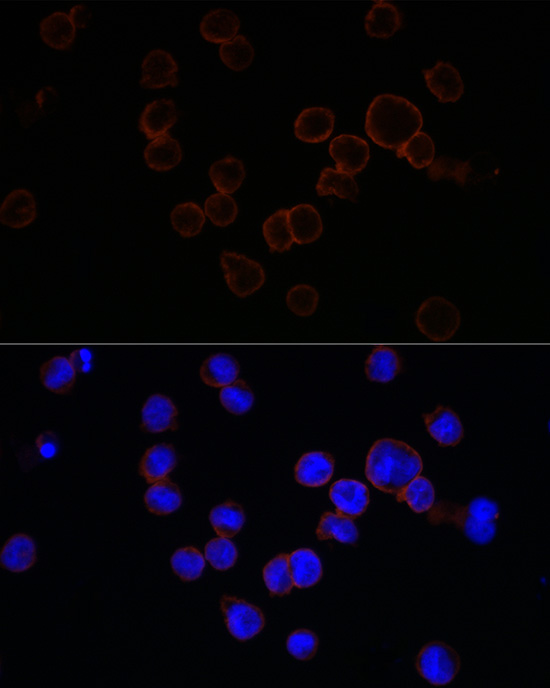 Rabbit anti-ITGAM Polyclonal Antibody