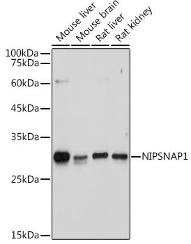 Rabbit anti-NIPSNAP1 Polyclonal Antibody