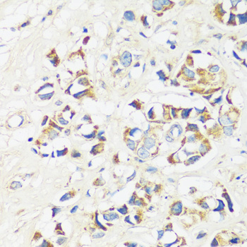 Rabbit anti-CADPS Polyclonal Antibody