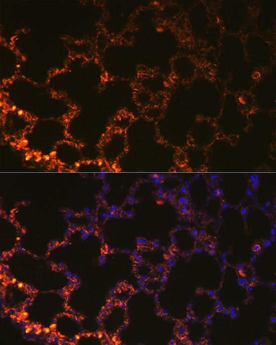 Rabbit anti-NAPSA Polyclonal Antibody