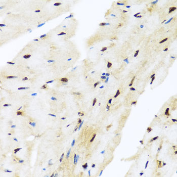 Rabbit anti-ZBTB17 Polyclonal Antibody
