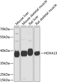 Rabbit anti-HOXA13 Polyclonal Antibody