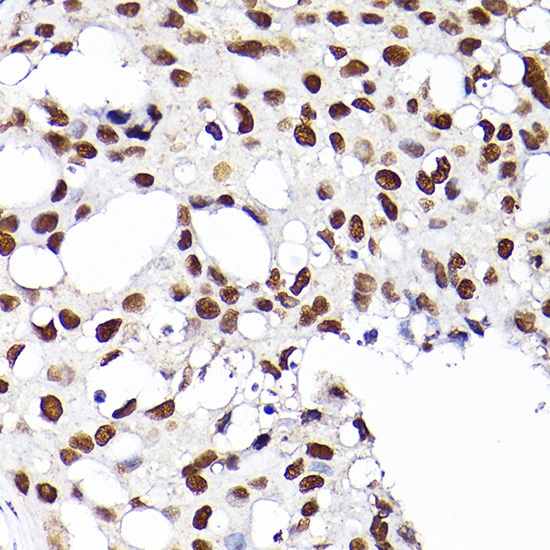 Rabbit anti-RCC1 Polyclonal Antibody