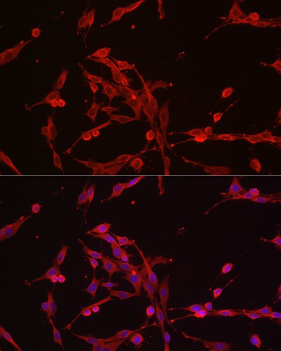 Rabbit anti-HK3 Polyclonal Antibody