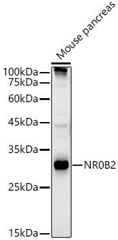 Rabbit anti-NR0B2 Polyclonal Antibody
