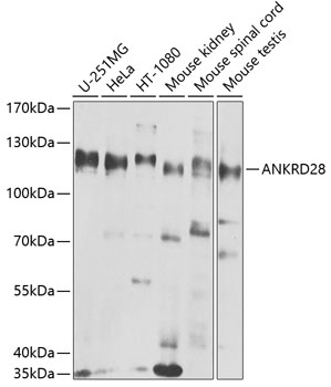 Rabbit anti-ANKRD28 Polyclonal Antibody