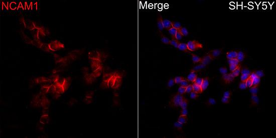 Rabbit anti-NCAM1 Polyclonal Antibody