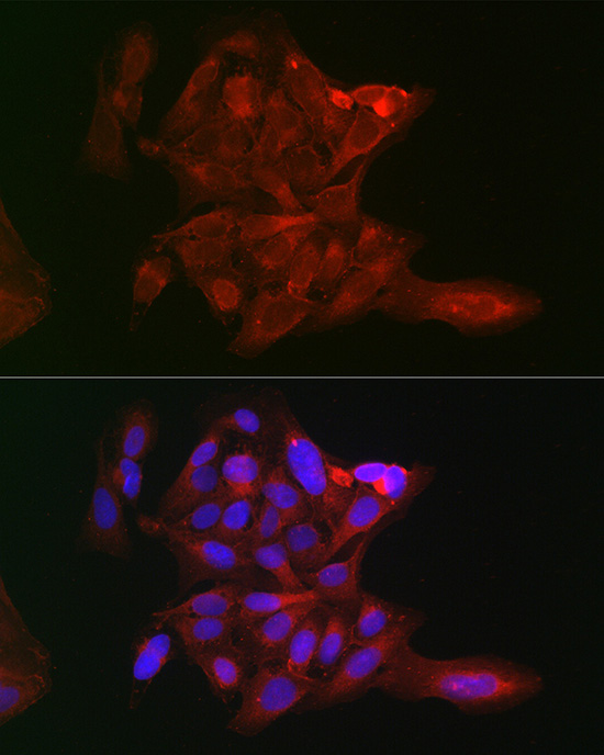 Rabbit anti-LOX Polyclonal Antibody