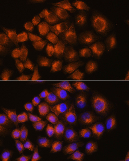 Rabbit anti-ADORA2A Polyclonal Antibody