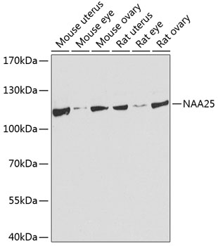 Rabbit anti-NAA25 Polyclonal Antibody