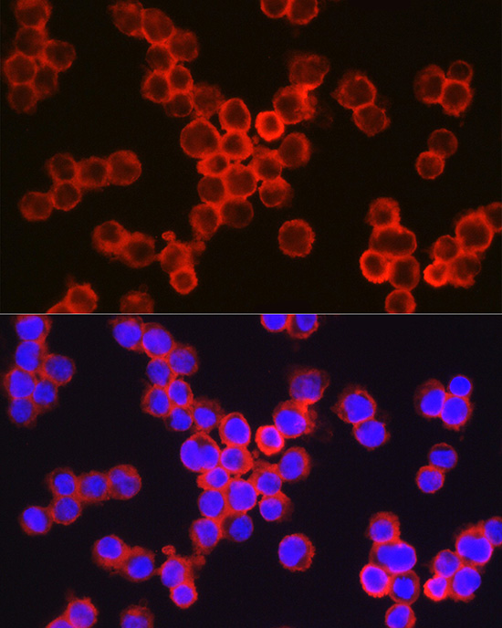 Rabbit anti-ITGAM Polyclonal Antibody