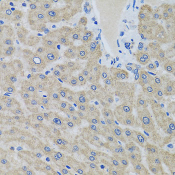 Rabbit anti-EIF2S3 Polyclonal Antibody