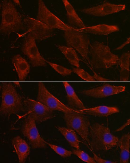 Rabbit anti-UGT1A1 Polyclonal Antibody