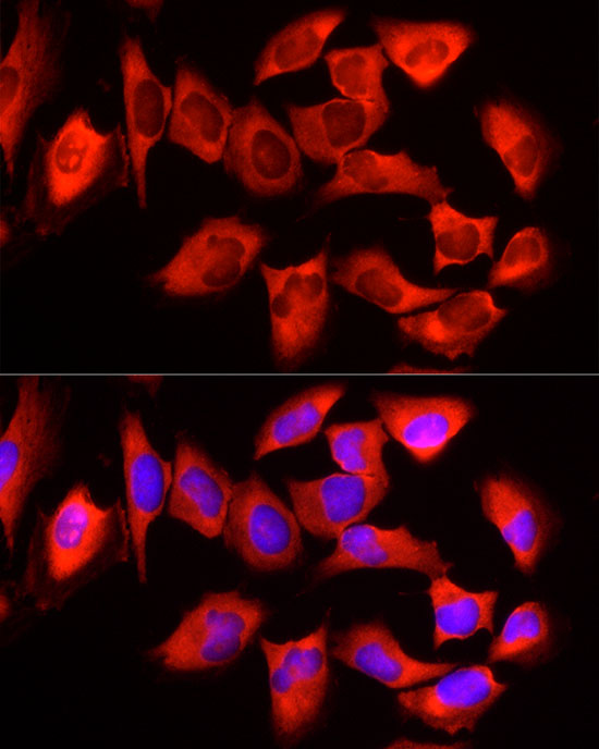 Rabbit anti-YTHDF3 Polyclonal Antibody