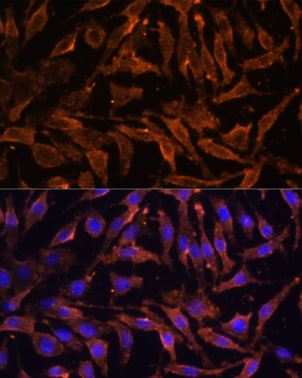 Rabbit anti-TNFRSF11A Polyclonal Antibody