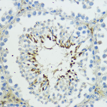 Rabbit anti-TRIP12 Polyclonal Antibody