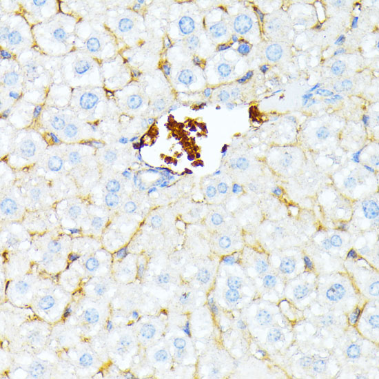 Rabbit anti-SPTA1 Polyclonal Antibody