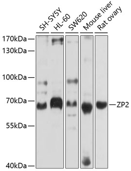 Rabbit anti-ZP2 Polyclonal Antibody