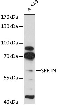 Rabbit anti-SPRTN Polyclonal Antibody