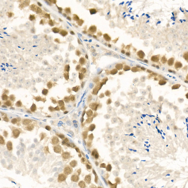 Rabbit anti-RAD51 Polyclonal Antibody