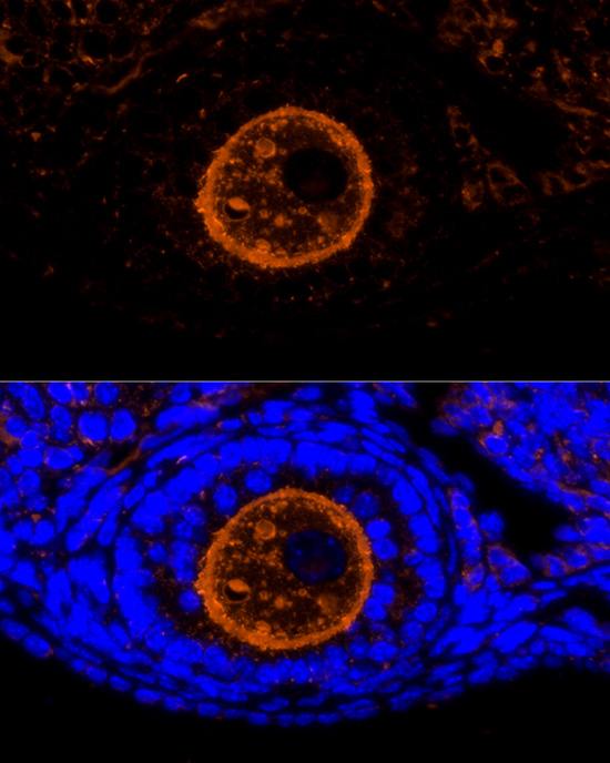 Rabbit anti-ZP2 Polyclonal Antibody