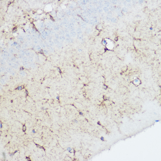 Rabbit anti-CAPN1 Polyclonal Antibody
