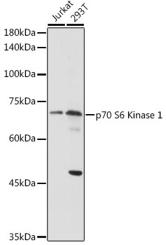 Rabbit anti-RPS6KB1 Polyclonal Antibody