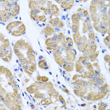 Rabbit anti-EIF2S3 Polyclonal Antibody