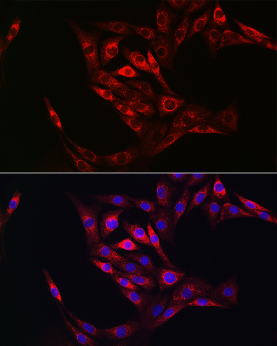 Rabbit anti-TGM2 Polyclonal Antibody