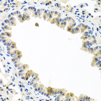 Rabbit anti-BMP5 Polyclonal Antibody