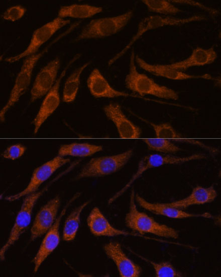 Rabbit anti-BRPF1 Polyclonal Antibody