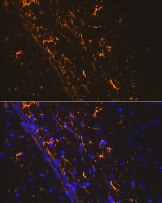 Rabbit anti-GFAP Polyclonal Antibody