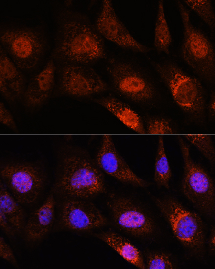 Rabbit anti-ZC3H12D Polyclonal Antibody