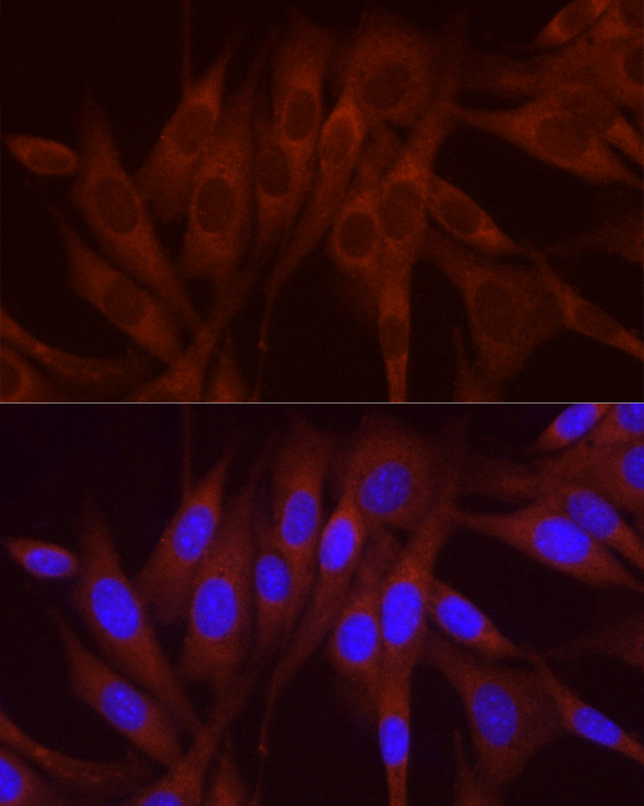 Rabbit anti-NUMB Polyclonal Antibody