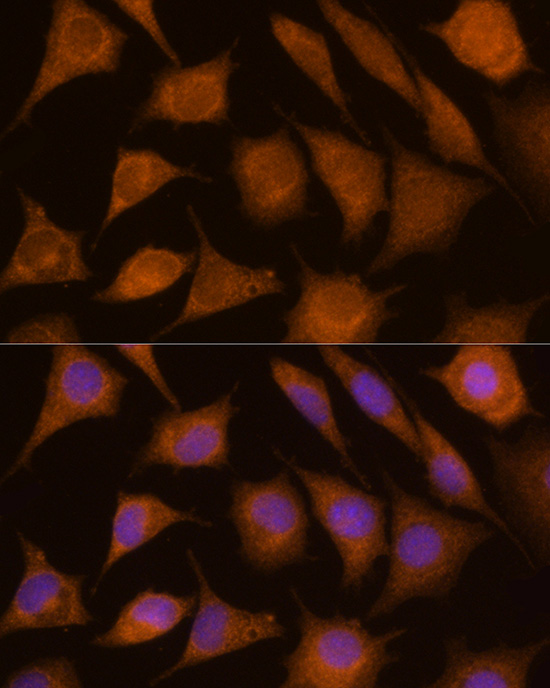 Rabbit anti-CTSC Polyclonal Antibody
