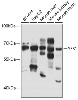Rabbit anti-YES1 Polyclonal Antibody