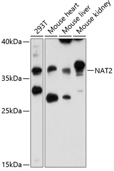 Rabbit anti-NAT2 Polyclonal Antibody