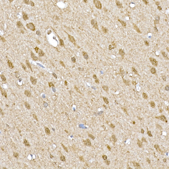 Rabbit anti-SOCS1 Polyclonal Antibody