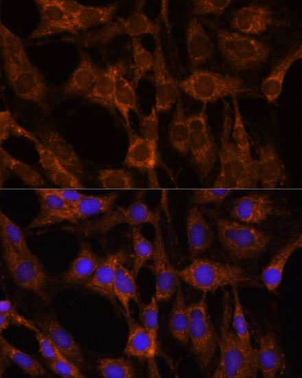 Rabbit anti-BRPF1 Polyclonal Antibody