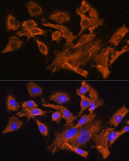 Rabbit anti-AVPR1A Polyclonal Antibody
