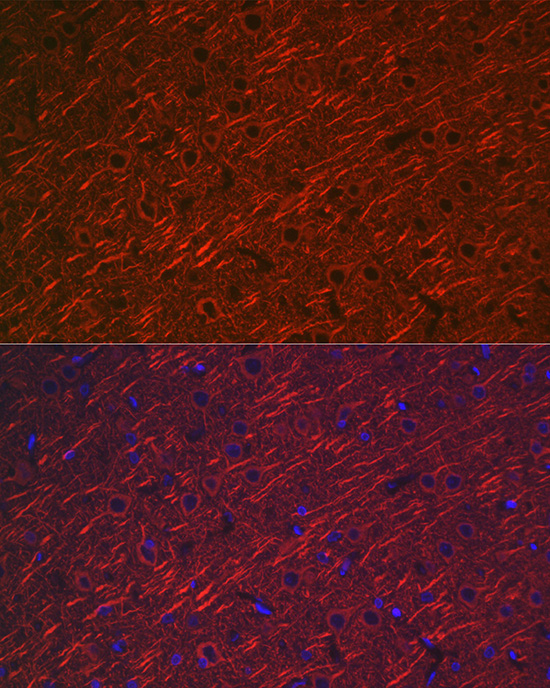 Rabbit anti-MAP2 Polyclonal Antibody