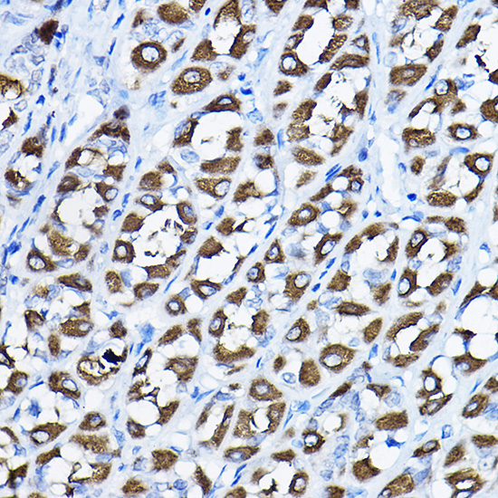 Rabbit anti-PGLS Polyclonal Antibody