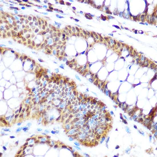 Rabbit anti-SP3 Polyclonal Antibody