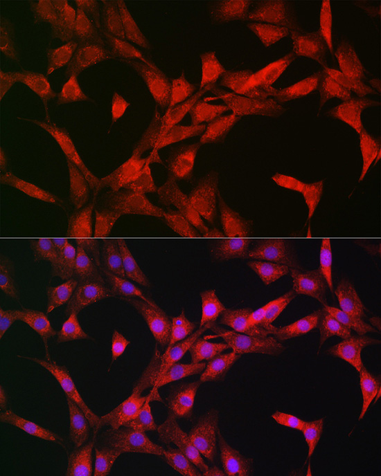 Rabbit anti-RPS6KB1 Polyclonal Antibody