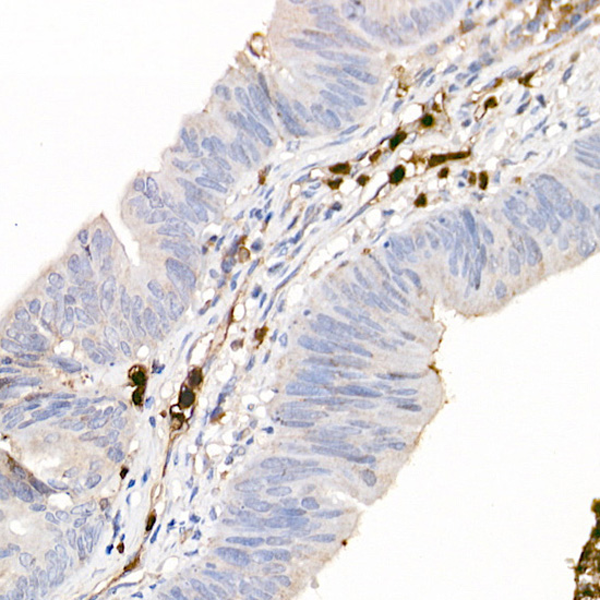 Rabbit anti-S100A12 Polyclonal Antibody